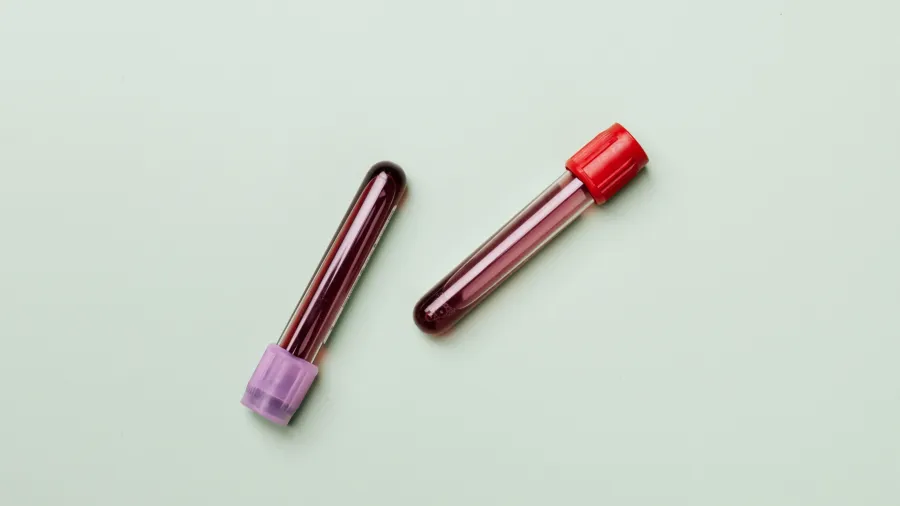 Photo by Karolina Grabowska: https://www.pexels.com/photo/blood-samples-4047146/