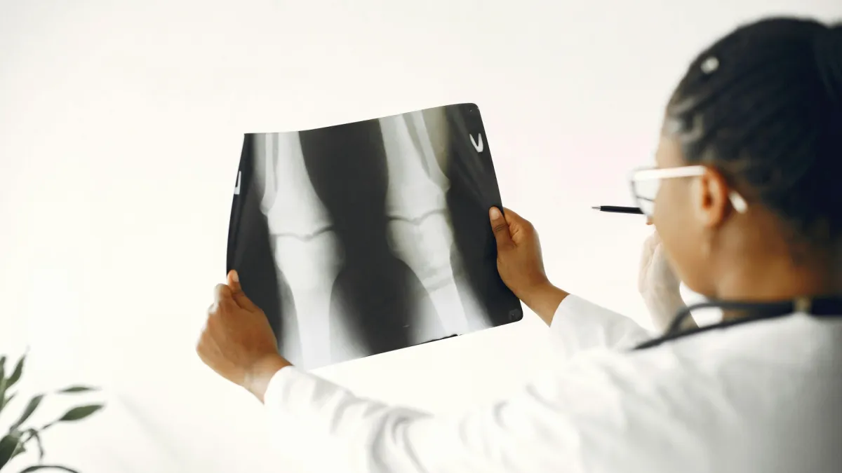 AI osteoporosis screening market to more than double by 2036
