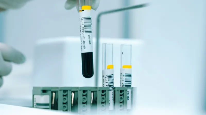 NHL CAR-T therapy market reaches $3.2b