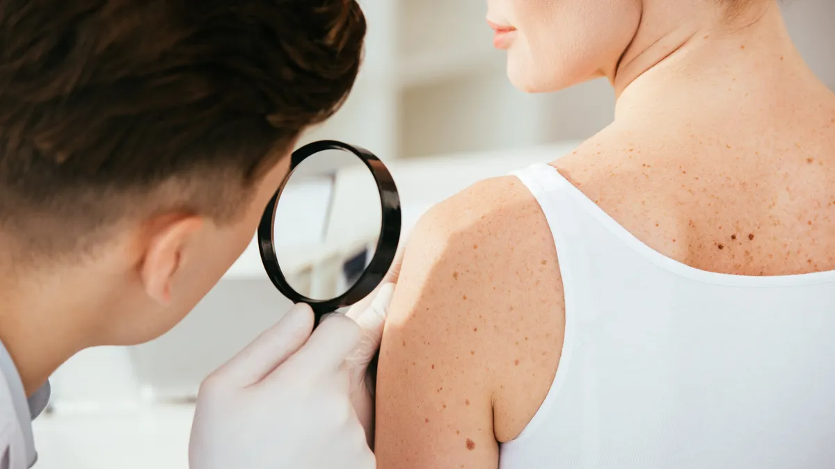 Melanoma cases in 8MM to reach 263,000 by 2035