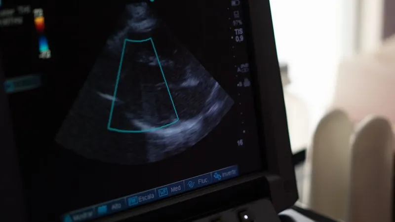 AI, handheld imaging to drive ultrasound-on-chip market growth