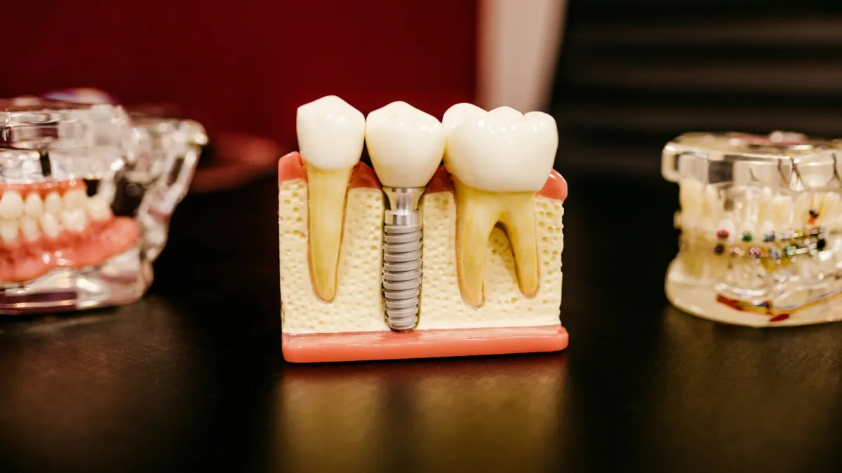 Global dental prosthetics market to reach $13.7b by 2034