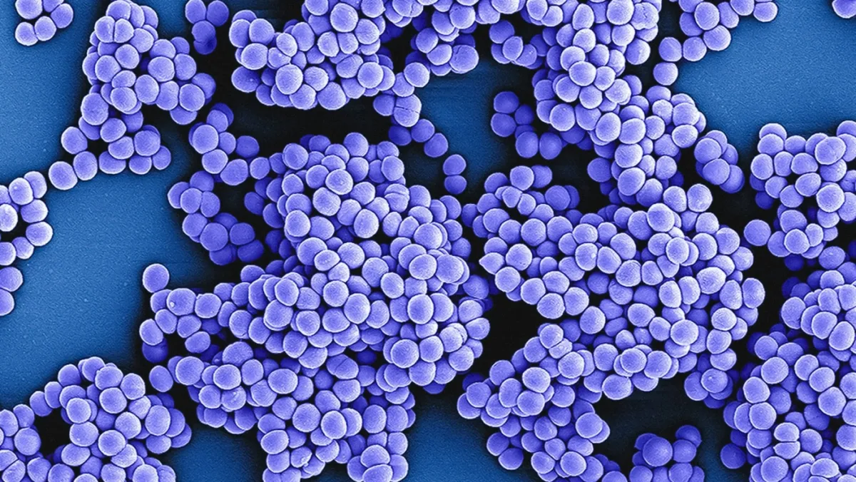MRSA therapeutics market seen at $1.8b by 2034, GlobalData says