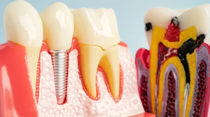 Dental articulators market on track to hit $323.8m by 2035 