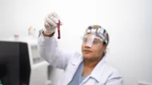 Global immunohematology market to reach $4.1b by 2034