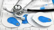 Medical electrodes market to be valued at $5.2b by 2033