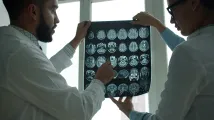 AI, cloud to drive $10.2b medical imaging market shift by 2033