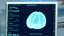 Neurological disorders, aging boost brain-computer interface market
