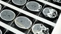 Chronic diseases to drive MRI systems market 2031 expansion to $9.68b 