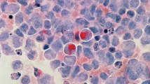 Rising elderly cancer burden to expand T-cell malignancies market