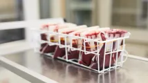 Apheresis market to hit $4.4b by 2031 on autoimmune, surgical demand