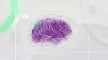 AI in healthcare market targets massive growth as data volumes surge