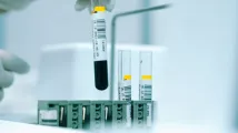 NHL CAR-T therapy market reaches $3.2b