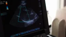 AI, handheld imaging to drive ultrasound-on-chip market growth