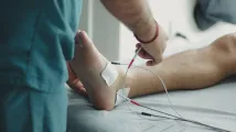 Neurostimulation devices power nerve repair market to $12.64b