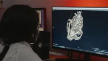 Chronic diseases to fuel $6.3b medical imaging software boom
