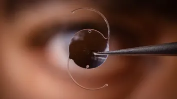 Global intraocular lens market to be valued at $6.17b by 2030