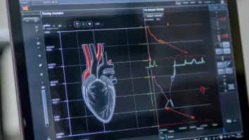 India’s cardiovascular monitoring devices market to reach $153m in 2036