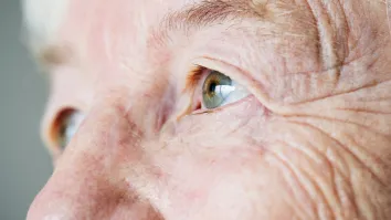 7MM age-related macular degeneration market to reach $20.5b by 2034