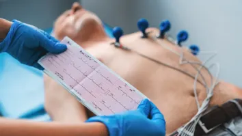 Advanced imaging, telemedicine drive heart attack diagnostics market to $21b by 2033