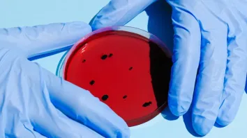 Infectious diseases, fast diagnostics drive clinical microbiology market