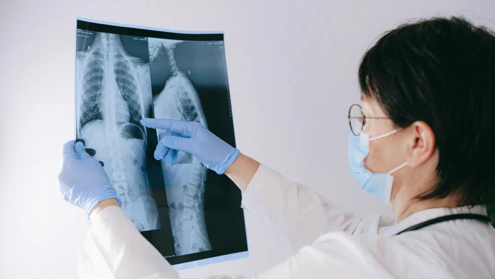 Chronic pain surge boosts spinal cord stimulation market to $4.8b by 2032