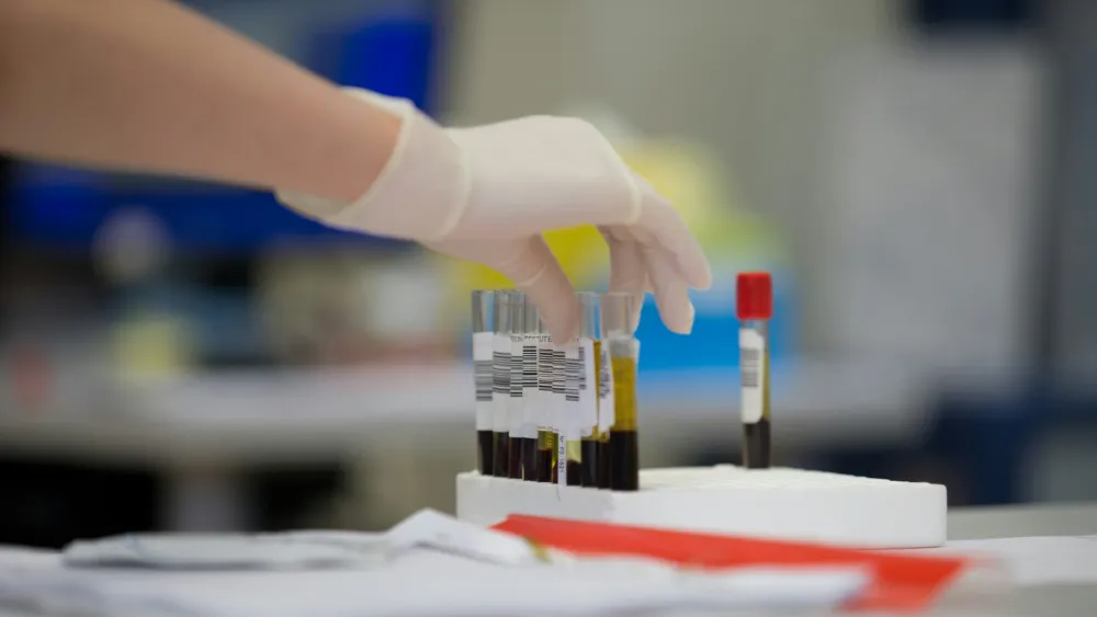 Biomarkers market set for 11% CAGR on early detection push
