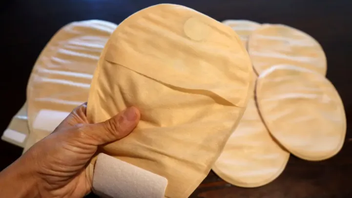 Ostomy dressing market to see $4.73b spike in 2031 as cancer cases surge