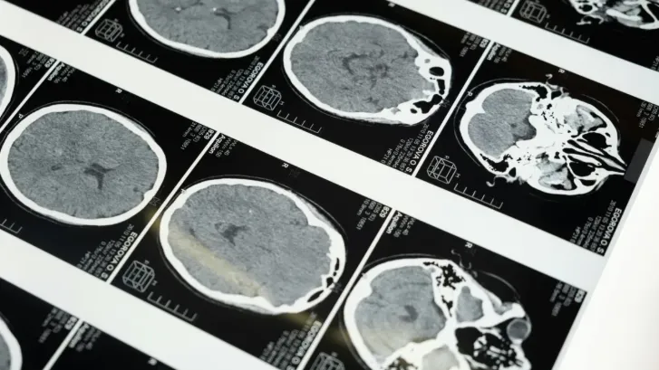 Chronic diseases to drive MRI systems market 2031 expansion to $9.68b 