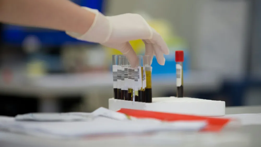 Body fluid analysis market to hit $3.65b on neurological and cancer demand