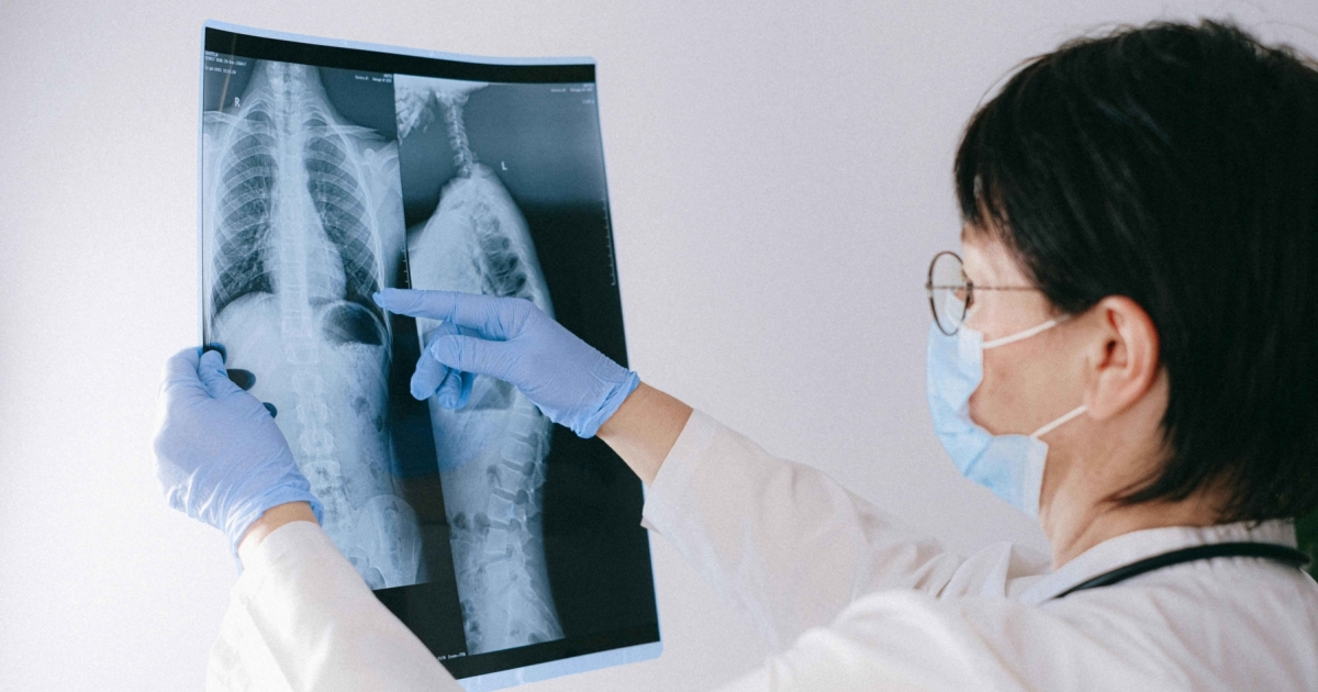 Chronic pain surge boosts spinal cord stimulation market to $4.8b by 2032